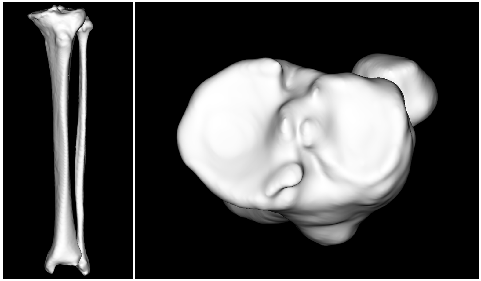 /information/images/2025/08/27/5169922bb64c242c4745c3713f397614.png 2.png